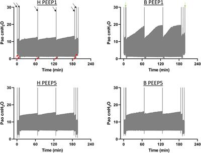 Hidden Microatelectases Increase Vulnerability to Ventilation-Induced Lung Injury